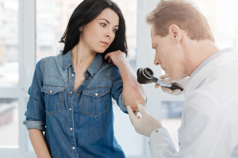 4 common signs of developing psoriasis